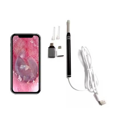 Mini Camera Earwax Picker, Nasal, Dental &amp;amp; Otoscope Cleaning Tool - 4.5mm 500W HD Visual Ear Scoop Endoscope