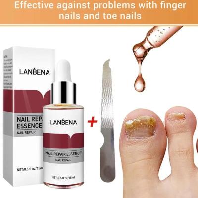 Nail Repair Anti-Infection Serum - 15ml